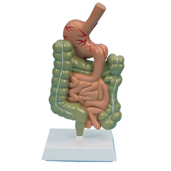 Модель поражения толстой кишки, патологические заболевания, Анатомическая модель желудка, Модель органов, модель человеческого тела  2