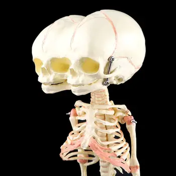 Человеческий Младенец Деформирован для Исследования Головы Черепа Модель Скелета Анатомический Анат  5